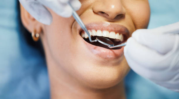 Best Chipped Tooth Repair Near Me  in Rkside, PA